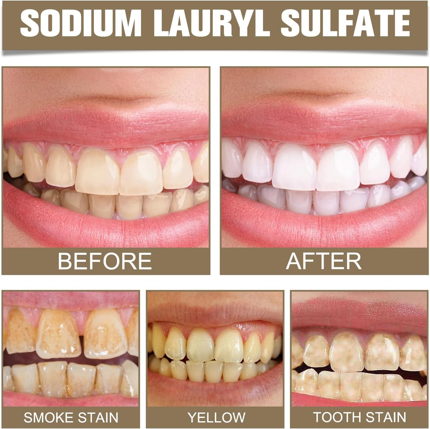 Tooth Refresh Toothpaste, Fresh Breath Whitening Toothpaste, Natural Oral Care & Enamel Repair, Helps Remove Coffee, Tea & Wine Stains, Fresh... - Image 5