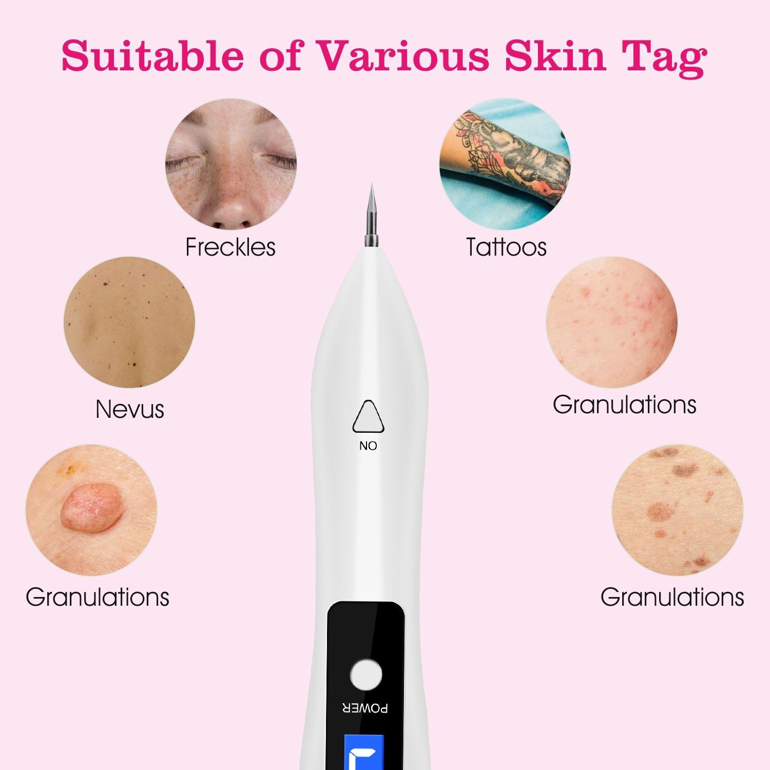 Skin Tag Repair Kit Portable Beauty Equipment Multi-Level with Home Usage USB Charging LCD Level Adjustable 6 Replaceable Needles - Image 3